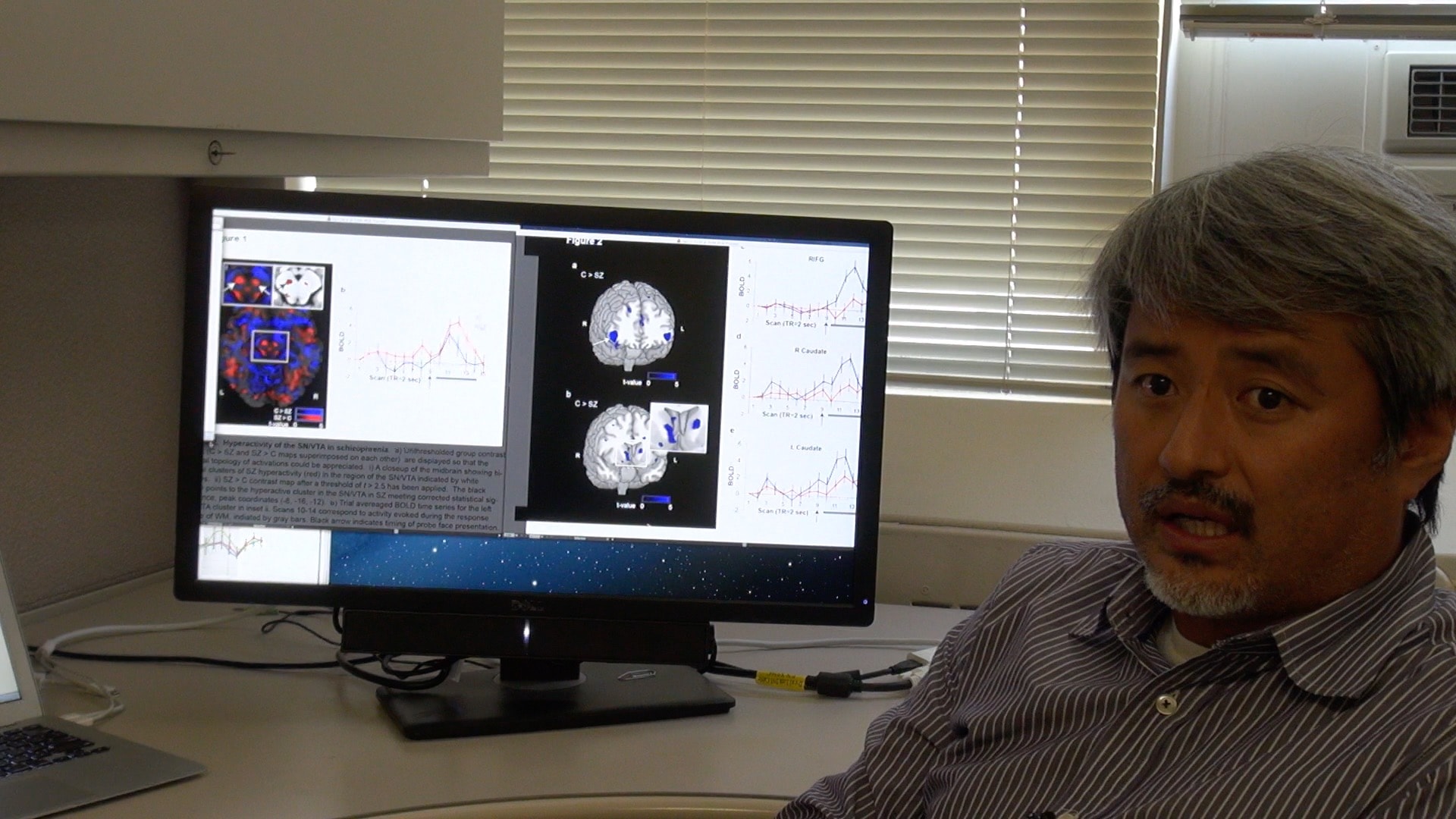 Researcher with brain scan data